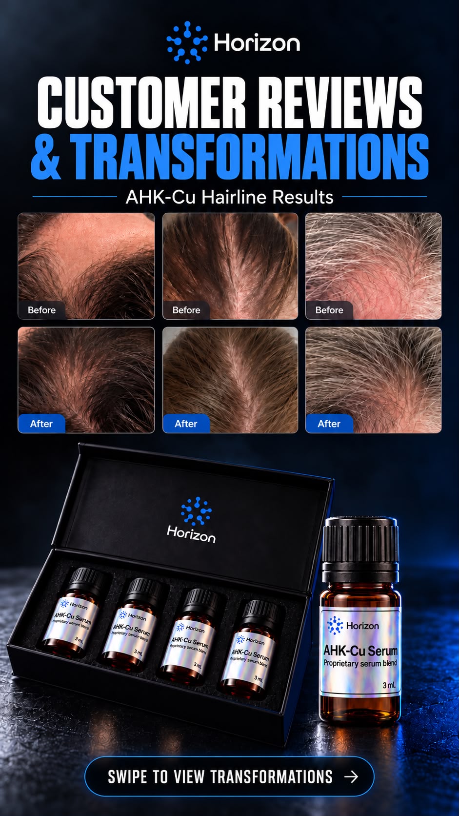 AHK-CU | HAIRLINE REGROWTH KIT